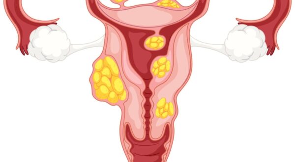 Nguyên nhân khiến phụ nữ dễ mắc bệnh phụ khoa
