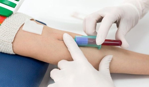 Xét nghiệm máu định kỳ