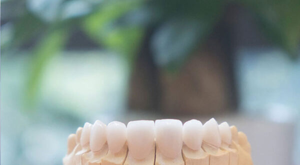 Ứng dụng của răng sứ Katana