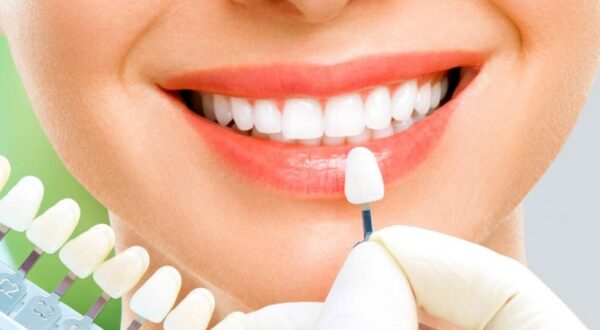 Đặc điểm nổi bật của răng sứ Katana