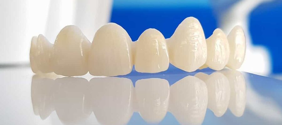 Các loại răng sứ phổ biến