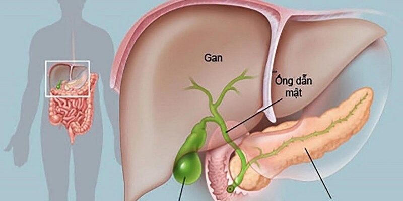 Cất túi mật bằng bảo hiểm y tế