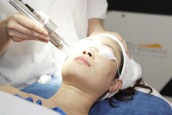 Những phương pháp cải thiện tình trạng sẹo rỗ